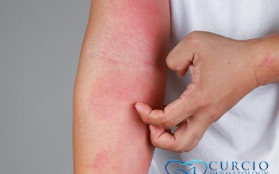 Common Skin Conditions in Tennessee – What You Need to Know